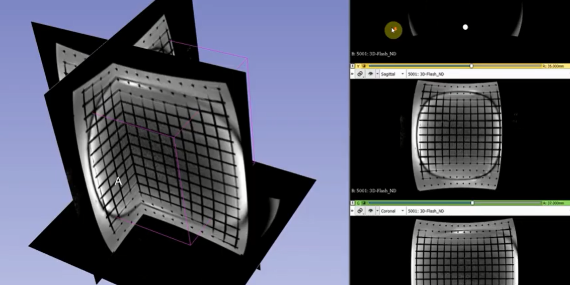 黃金標(biāo)準(zhǔn)X射線乳腺攝影對比度細節(jié)模體CDMAM 3.4